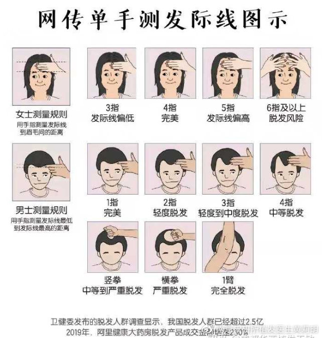 脱发烦恼怎么破几招化解头顶尴尬,头顶出油出汗脱发严重是怎么回事