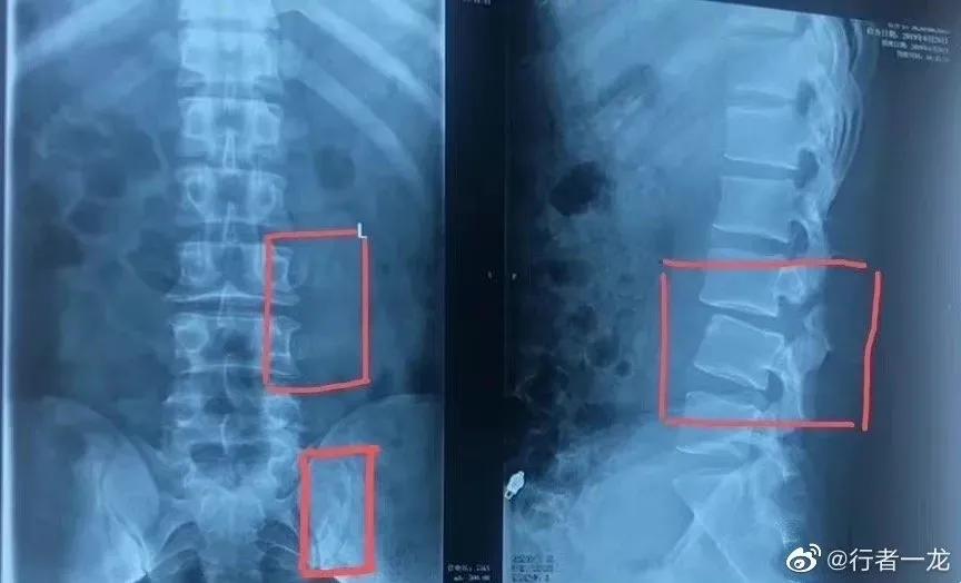 武林风2018一龙拳击比赛实况,武林风王者归来武僧一龙