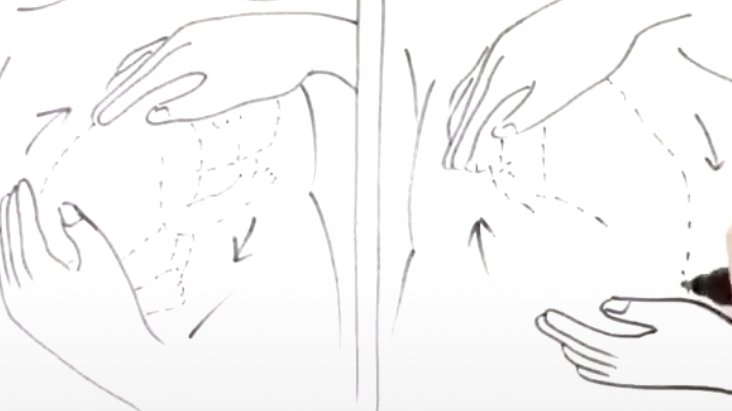 胎位臀位不正怎么办,臀位胎位不正的原因及纠正方法