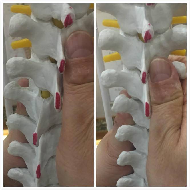 腰间盘突出颈椎病怎么彻底治愈,颈椎病能不能完全治愈