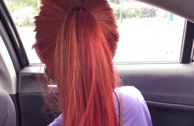 头发油脱发是多洗头还是少洗头,头发吹干好还是自然干更容易脱发