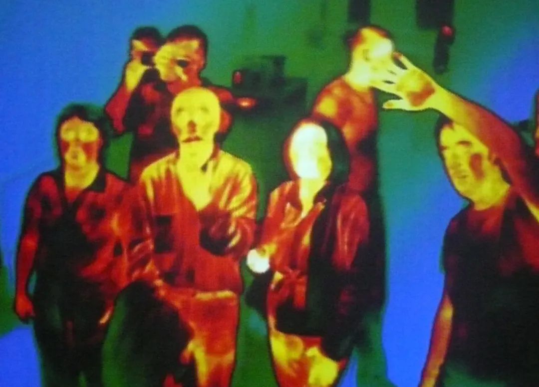 口腔内壁凹凸不平图片,口腔内壁凹凸不平褶皱