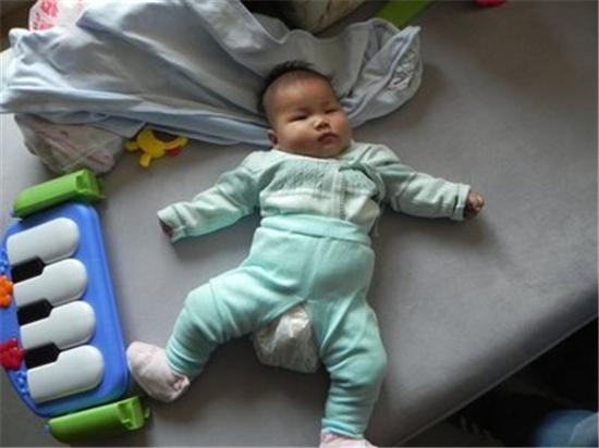 孩子烫伤先脱了衣服,孩子烧伤先脱衣服伤情加重