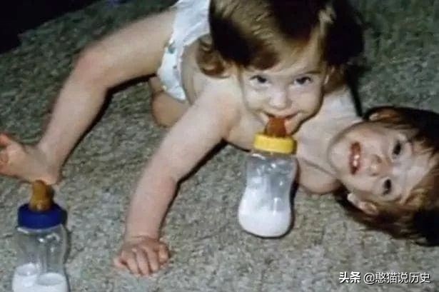 世界上最诡异的双头连体人,两个大脑如何控制同一个身躯