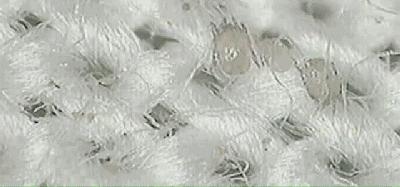 除螨仪只要一块钱有效去除螨虫,除螨神器让螨虫无处可逃