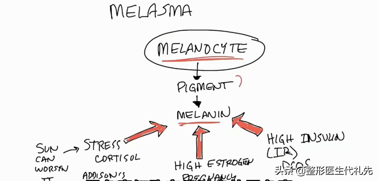 褐斑是什么病,褐斑形成原因