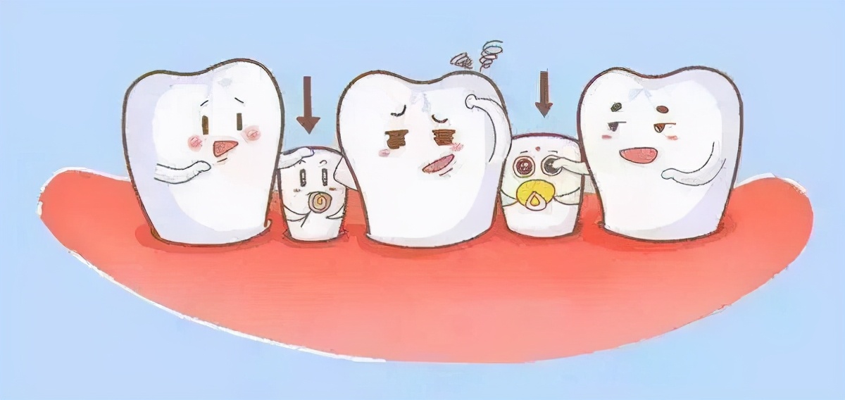 儿童龋齿发生后的补救方法,儿童初期龋齿的最佳处理方案