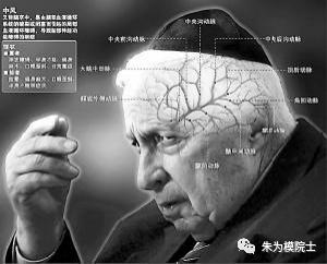 中风健康小知识,中风西医怎么预防