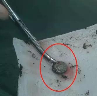 女孩肚子痛还流血，隔了几天走路都不对劲了！