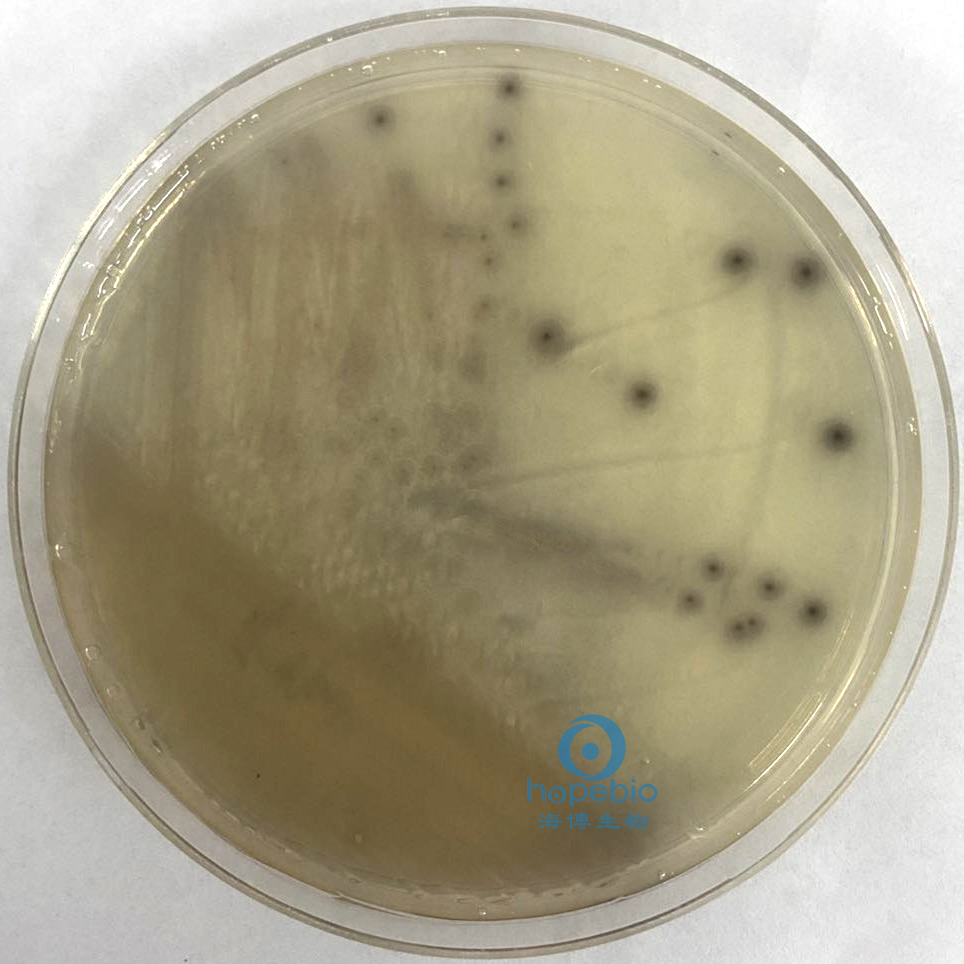 霍乱弧菌分型鉴定,霍乱弧菌的鉴定方法有几种