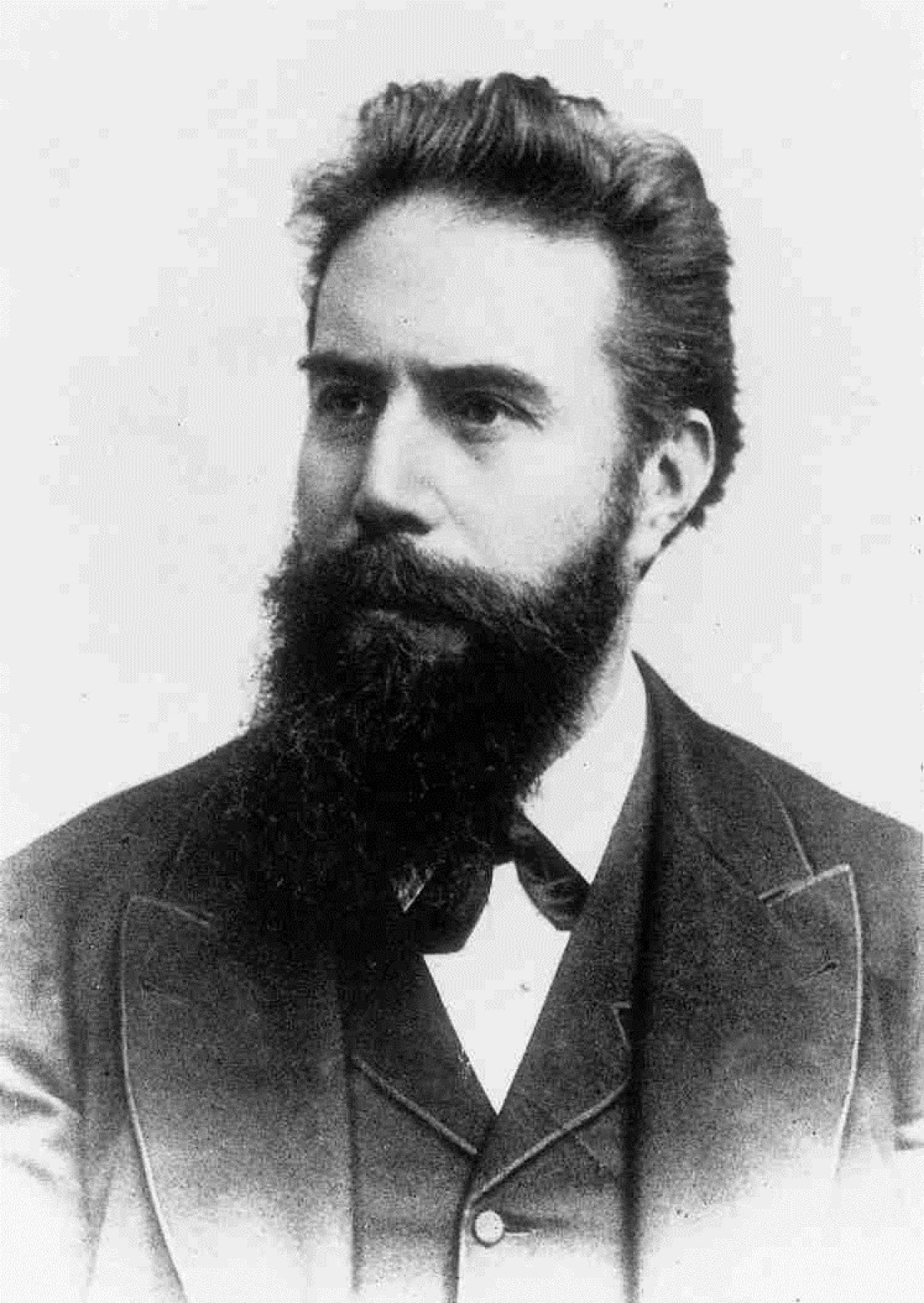 什么是x射线y射线,什么是x射线检测