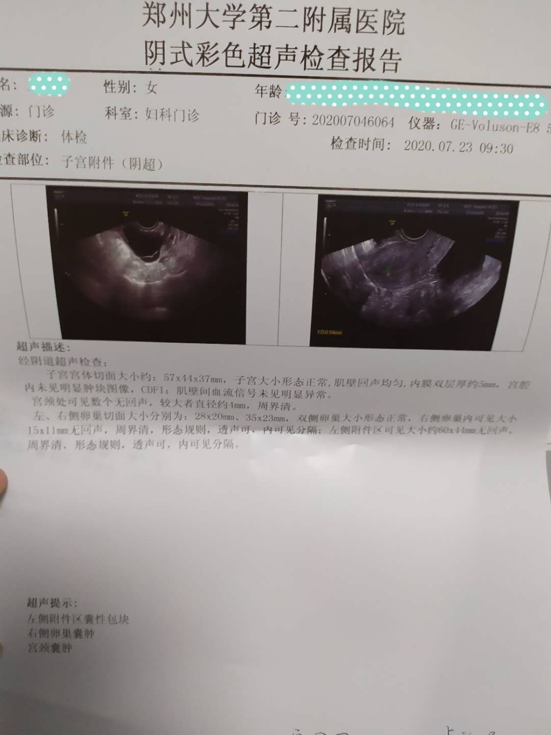 卵巢囊肿的治疗方式最好的是什么,卵巢囊肿5.5厘米保守治疗可以吗