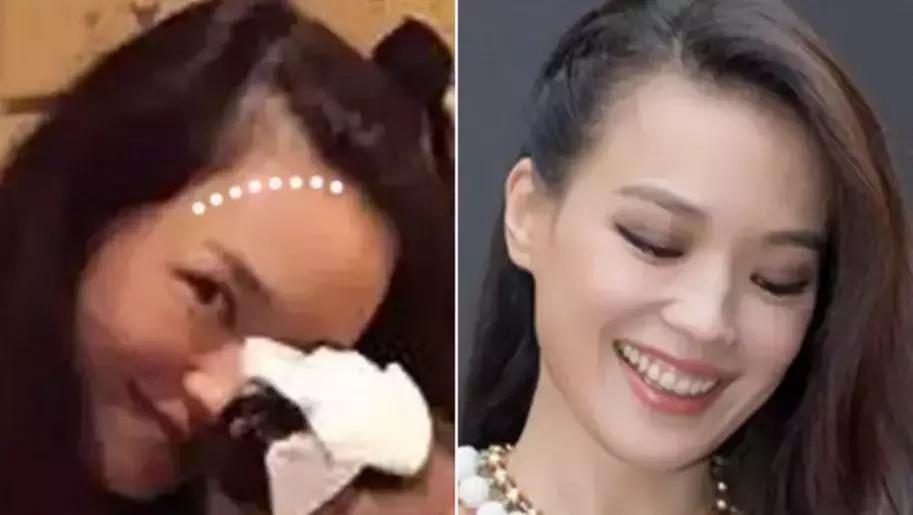 张歆艺防止妊娠纹,张歆艺预防妊娠纹