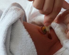 新生儿脐带消毒的正确方法,新生儿脐带消毒视频教程