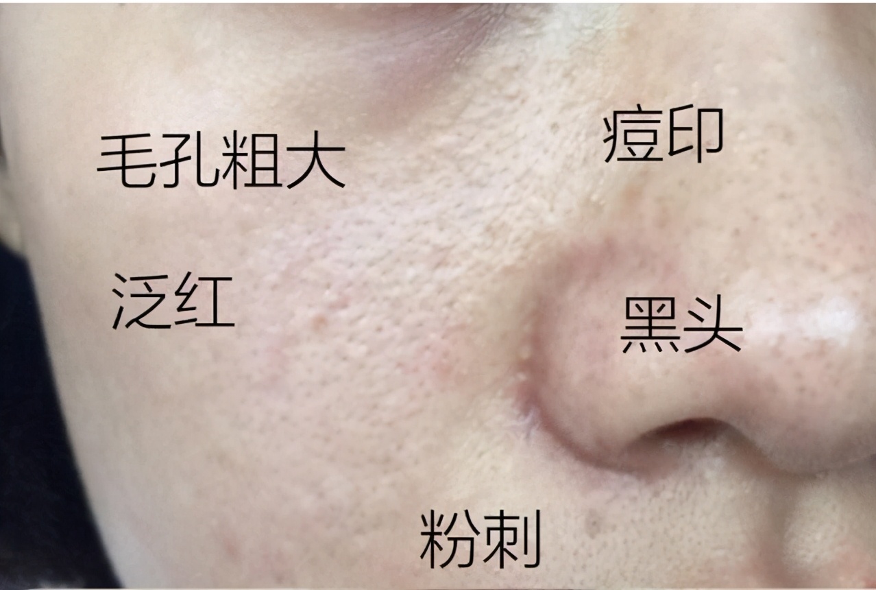 粉底液卡粉浮粉斑驳怎么办,unny粉底液干皮怎么涂不卡粉浮粉