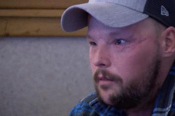 手术的时候医生对你做了什么,手术时切了一片肺叶