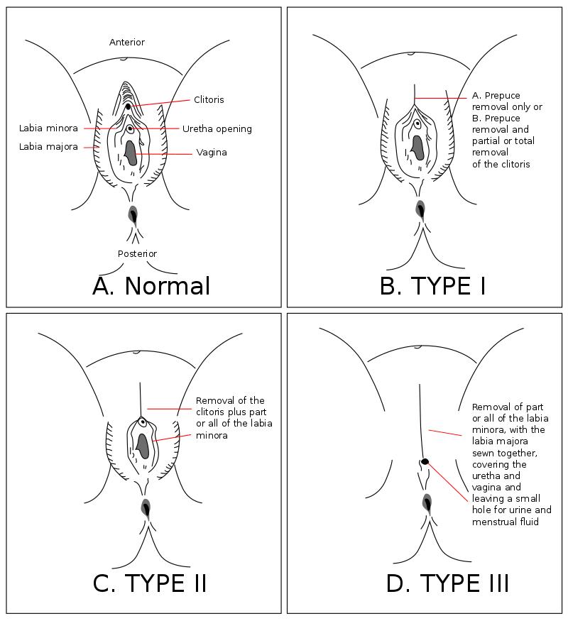 非洲女权里程碑！苏丹立法禁止割除女性阴部！