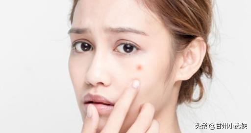 五十岁脸上长痘痘鼻子也长痘,脸上长痘痘身上长痘的原因