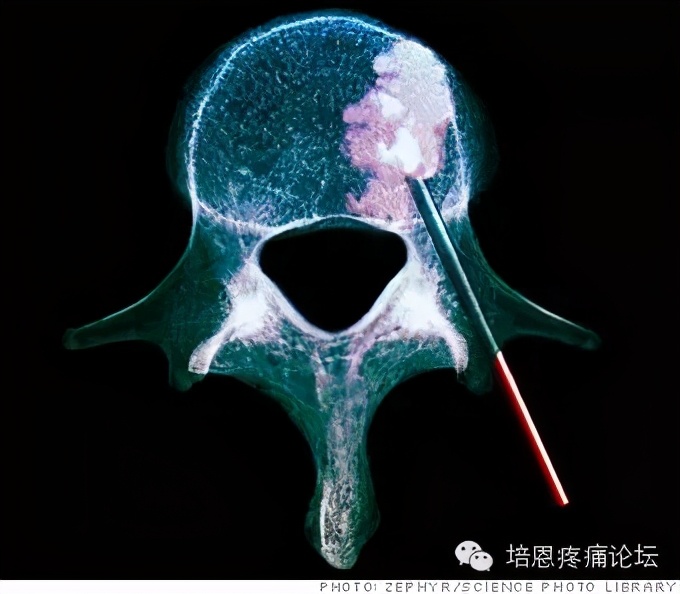 疼痛科需要有什么仪器,疼痛科必须具备的设备