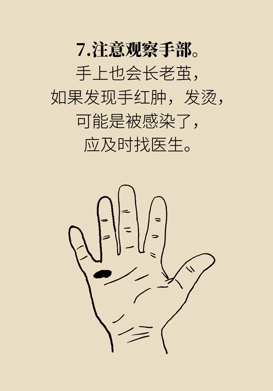 长了鸡眼该怎么办四大妙招教给你,长了鸡眼怎么治疗好得快