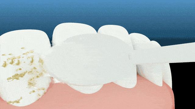 口臭20多年了怎样彻底根除,口臭很尴尬9个方法轻松消除口臭