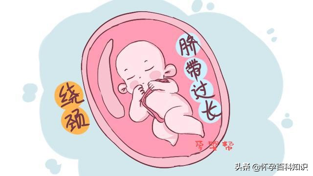 脐带绕颈宝宝自己怎么绕出来,宝宝脐带绕脖子孕妈有什么反应