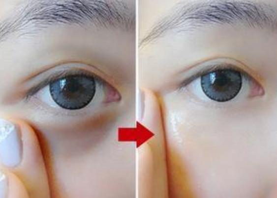 眼袋特别大用什么眼霜最好,有眼袋一般都擦什么样的眼霜