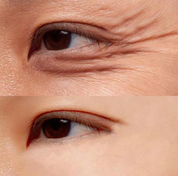 眼霜抗皱去细纹30-40岁用什么眼霜,十大公认的便宜又好用的眼霜推荐