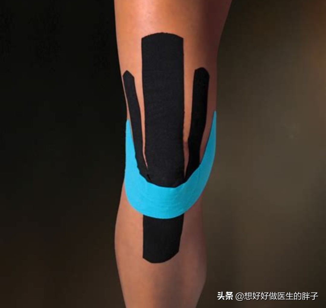 疫情期间不出门，选在室内原地跑可以吗？有哪些细节需要注意呢？