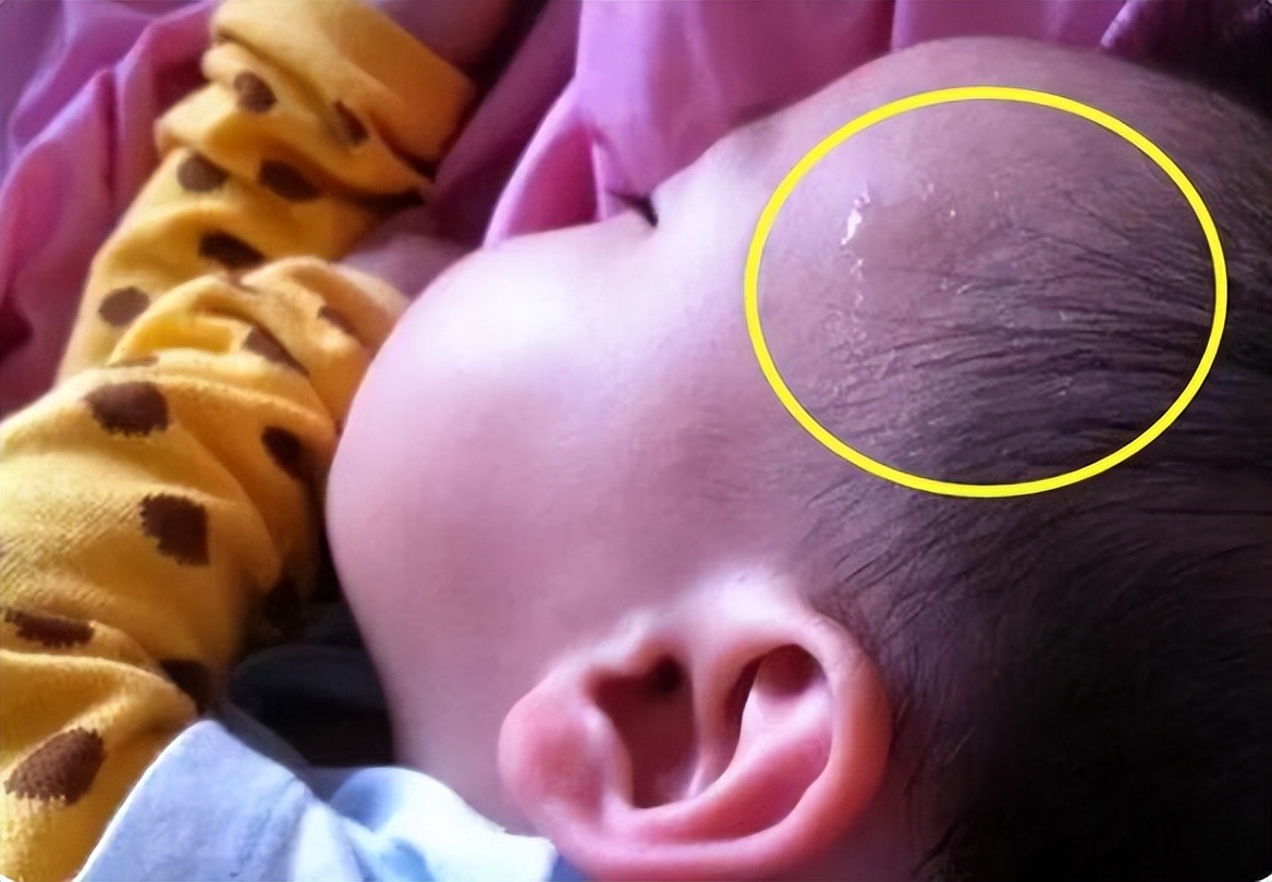 宝宝睡觉经常出汗是缺钙还是体虚,孩子缺钙睡觉出汗怎么回事