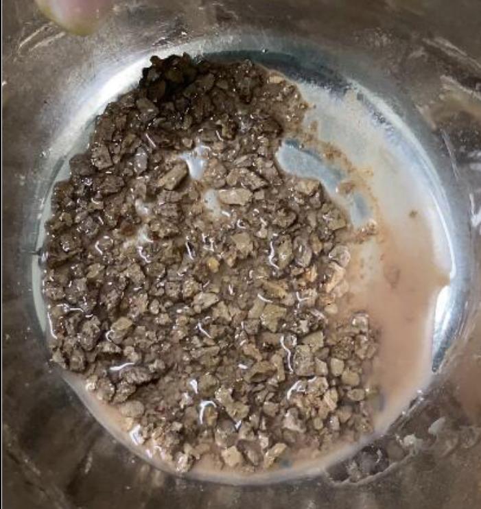 结石引发剧烈肾绞痛,该怎么办?常立高主任:这几个妙招要记住了