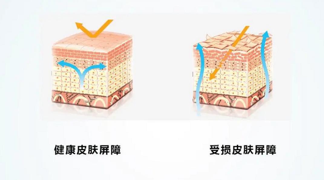 女性*处私**毛发可以剃掉？*处私**毛发的这3种用处，你需要了解