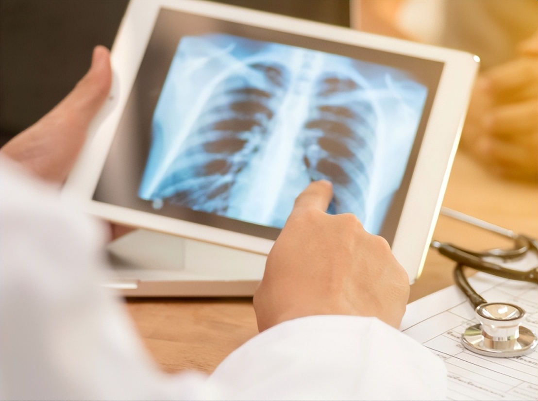 国产球囊治疗小儿肺动脉瓣狭窄可行吗？安全性如何？