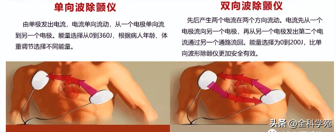 急救除颤仪麦邦aed7000,急救心脏除颤仪使用方法