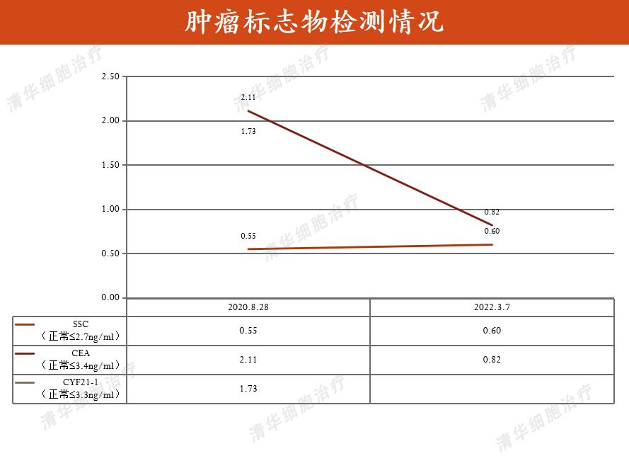鼻咽癌放疗25次的报告,鼻咽癌化疗两次放疗33次严重吗