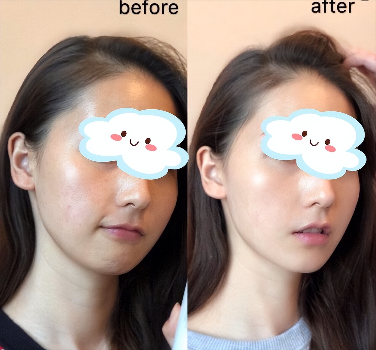 如何改善皮肤暗黄毛孔粗,如何改善皮肤暗黄的问题