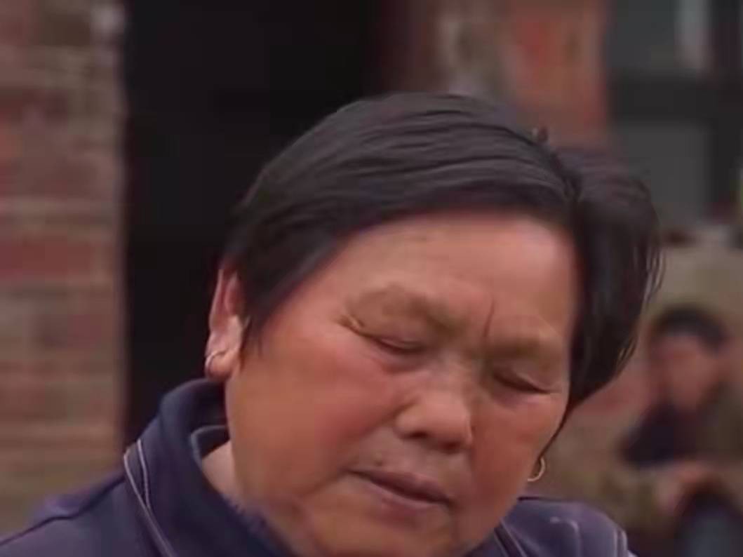 男子手长满树疙瘩是什么病,男子手长满树疙瘩手术了吗