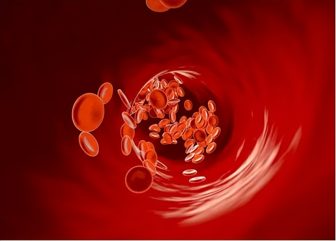 缺血性脑卒中中医治疗原则,急性缺血性脑卒中诊治指南最新版