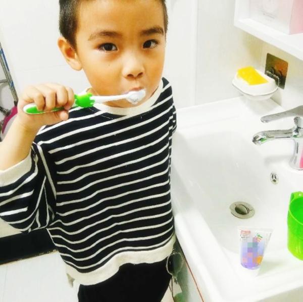 孩子上牙的牙缝特别宽要矫正吗,宝宝牙缝大换了牙齿会不会改善