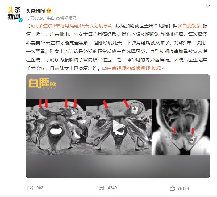 女子每月痛经,女性痛经5年加重