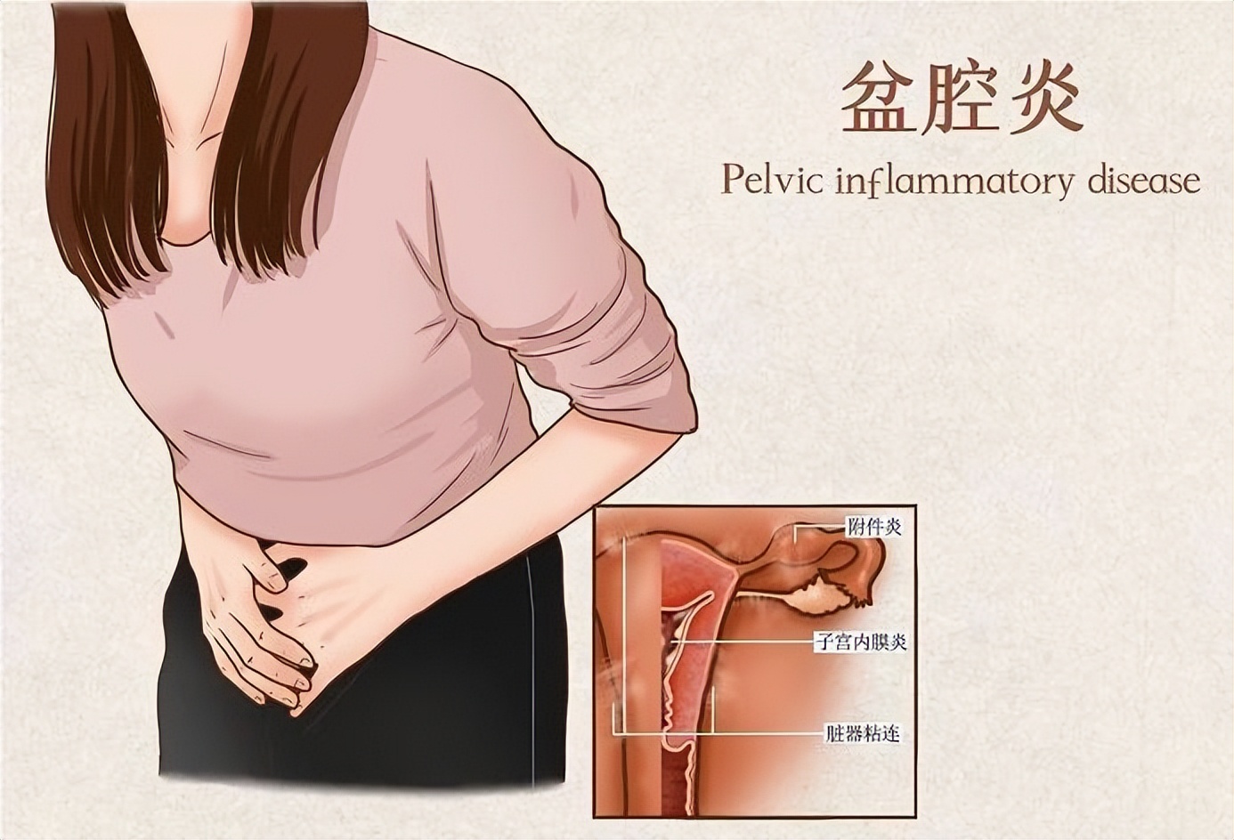 盆腔炎湿热为什么会疼痛,气滞血瘀型盆腔炎腰疼