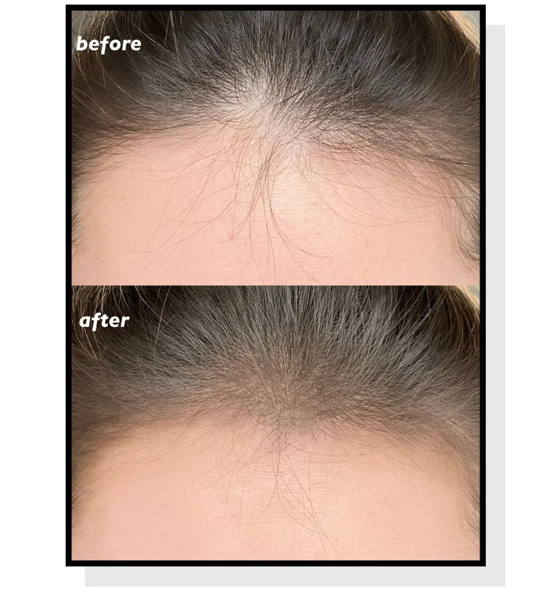 发量少发际线高发型解决方案,30-40岁男士发型稳重发际线高