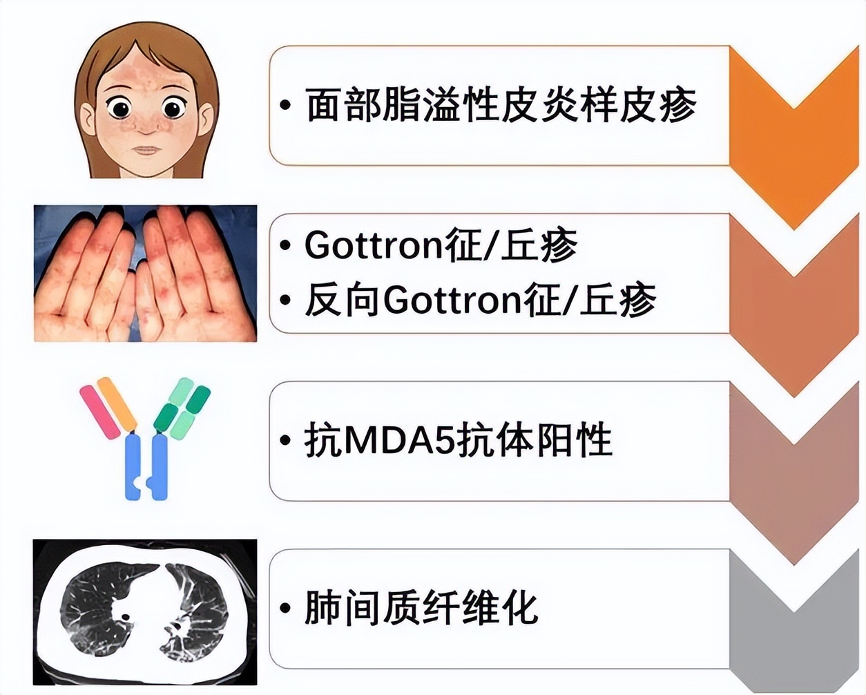 风湿免疫科专家解答,秦皇岛中医院风湿科