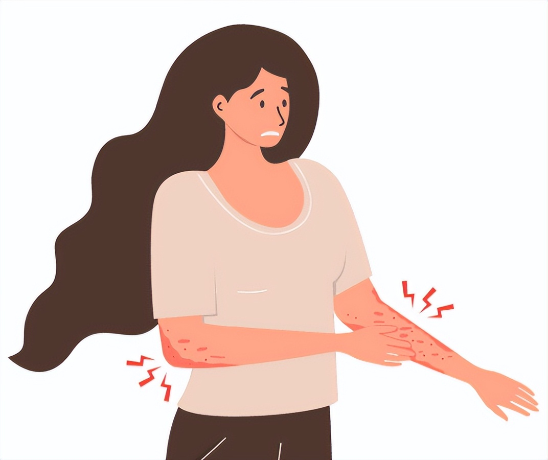 皮疹出现后发烧,皮疹发热咽痛