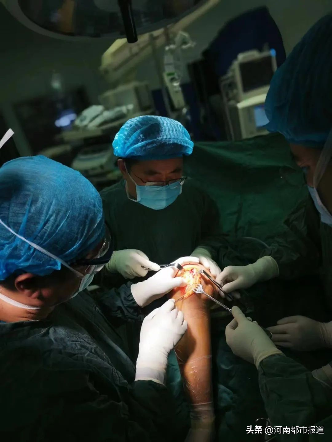 全球首例3d打印距骨表面假体置换,首例医生3d打印距骨表面植入人体