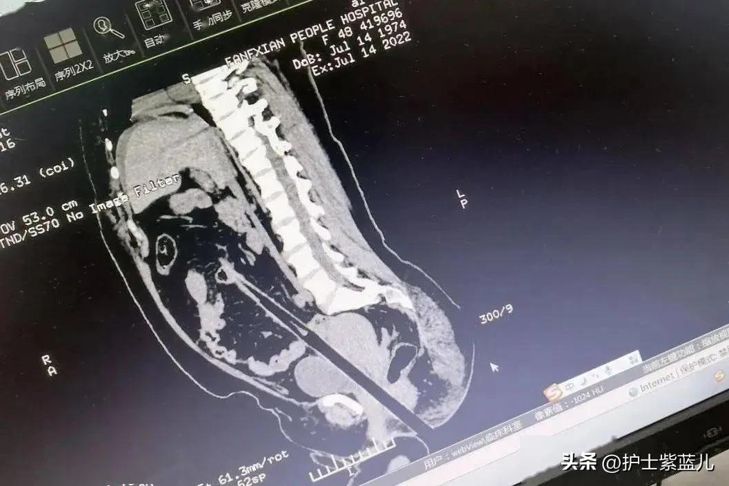 老人从高处跌落昏迷,老人不慎从台阶摔下躺在地上