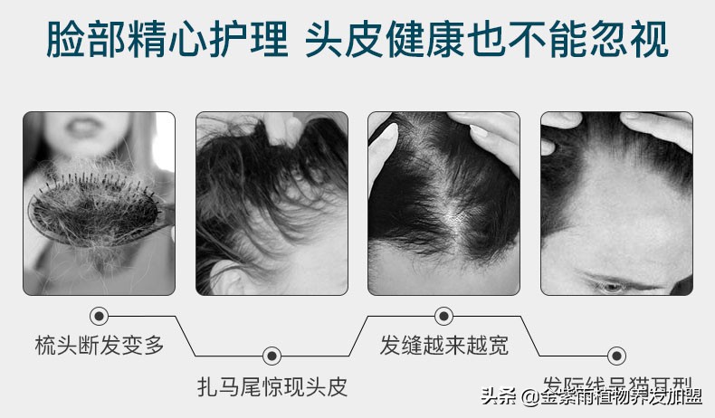 头疗加盟有哪些店铺好做,头疗加盟招商最新方案