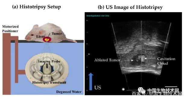科学家肝癌能治愈吗,科学家何时能彻底治愈肿瘤