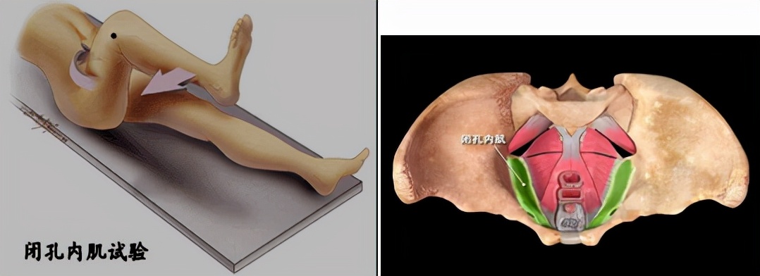 怀孕早期发现有阑尾炎怎么办,怀孕得阑尾炎怎么办胎儿能要吗