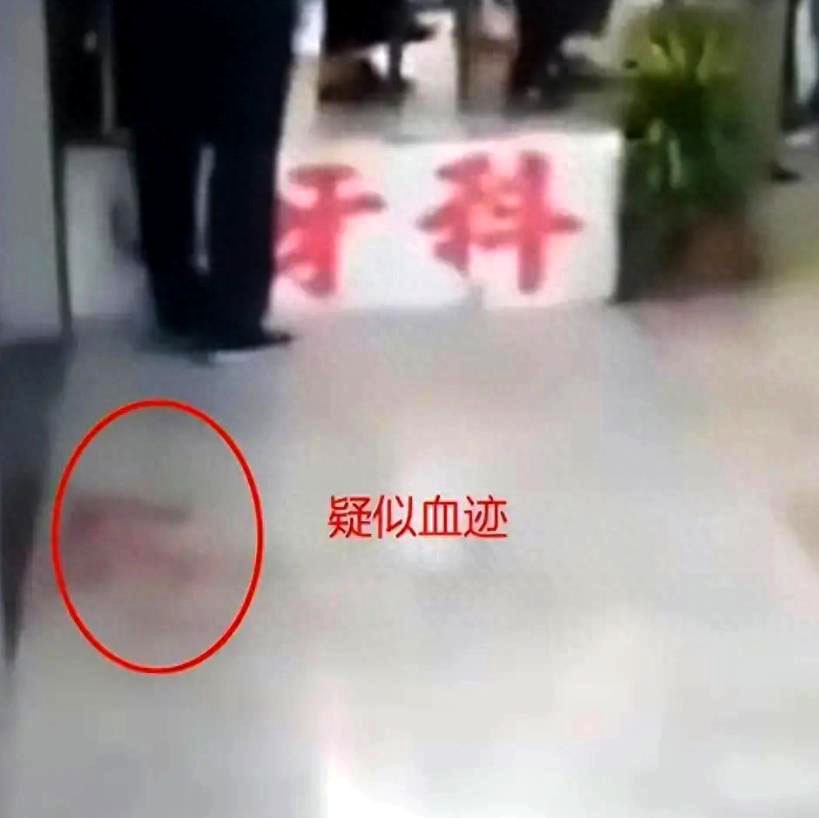 女子在诊所被人砍杀系情杀,女子刺伤牙医事件通报